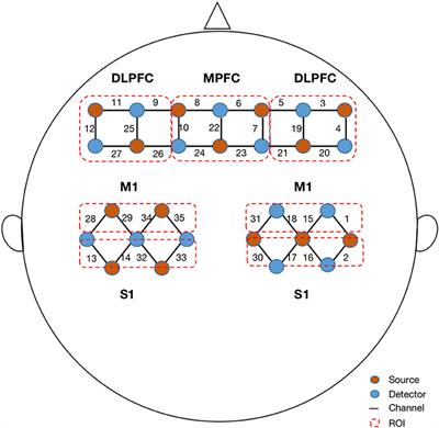 Resting-state functional connectivity for determining outcomes in upper extremity function after stroke: A functional near-infrared spectroscopy study